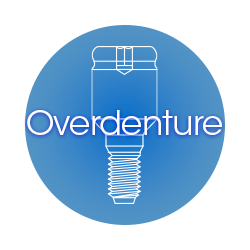 Overdenture